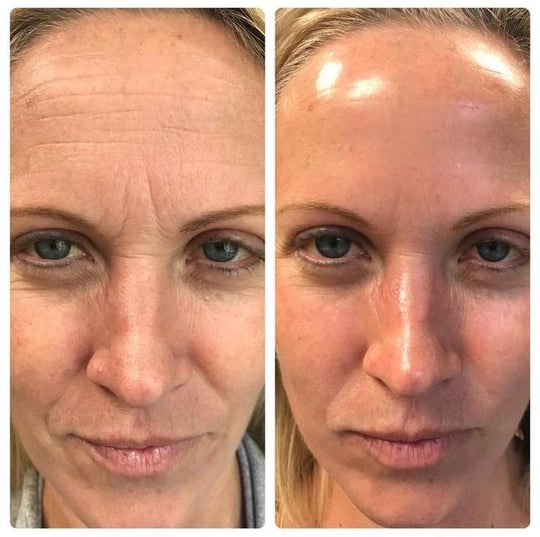 OFERTA Masajeador Facial - Simpli™